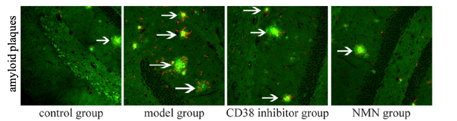 nmn improves cognitive deficits in alzheimer 3