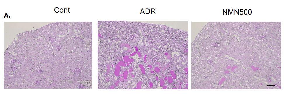 nmn kidney 2